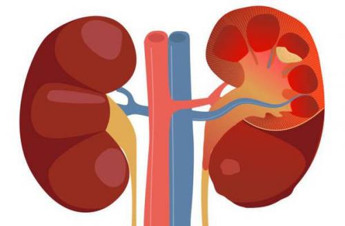 Препараты для лечения почек. Клиническая фармакология отдельных препаратов 05