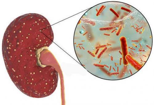Препараты для лечения почек. Клиническая фармакология отдельных препаратов 07