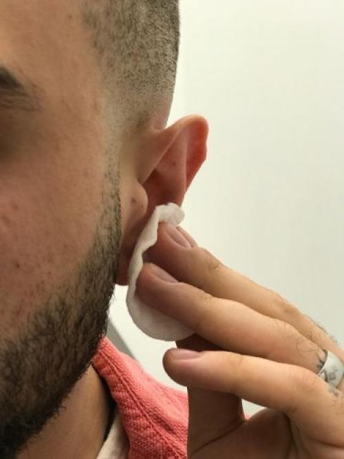 Как ухаживать за пирсингом в первые дни после прокола. Уход за пирсингом 02 Как ухаживать за пирсингом в первые дни после прокола. Уход за пирсингом 02