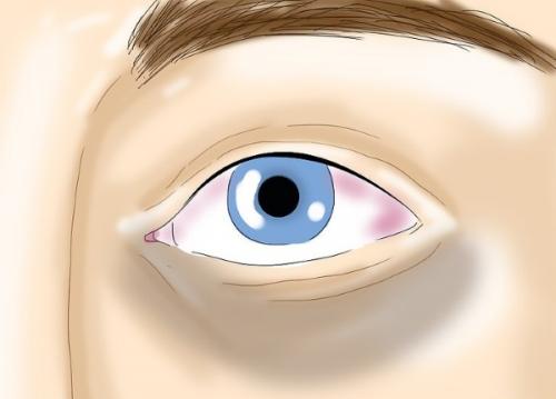 Какие материалы можно использовать для покалывания по всему телу, как иголками. Покалывание по всему телу, как иголками. Причины, что делать, симптом заболеваний