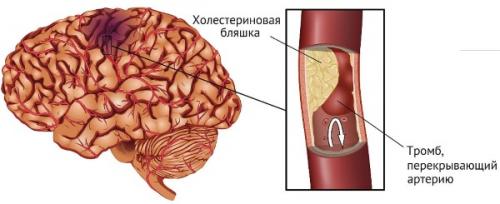 Какие материалы можно использовать для покалывания по всему телу, как иголками. Покалывание по всему телу, как иголками. Причины, что делать, симптом заболеваний