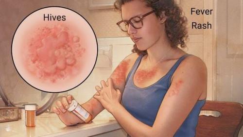 Жжение зуд и покалывание во всем теле: причины и способы борьбы 03