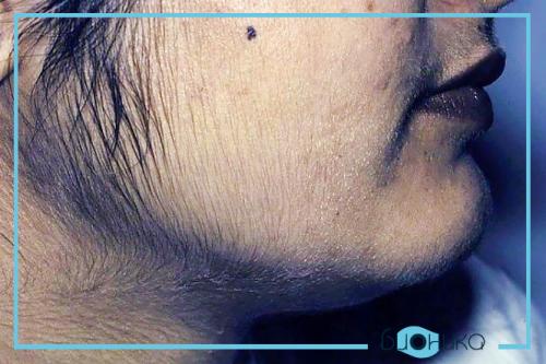 Как удалить волосы на лице и теле. Как удалить светлые и седые волосы на теле навсегда: ищем самый эффективный способ 01