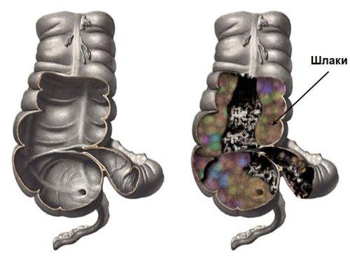 Меню раздельного питания по неумывакину. Система питания и очищения организма Ивана Неумывакина
