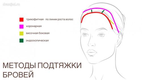 Подтяжка лица после 50 лет: как вернуть молодость без операции 07