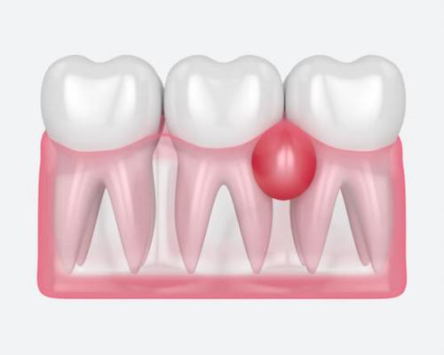 Ноющая боль в зубе. Зубная боль 03 Ноющая боль в зубе. Зубная боль 03