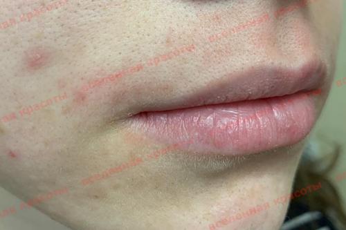 Как избавиться от усиков. О чем молчат девушки? Как избавиться от усиков? 10 Как избавиться от усиков. О чем молчат девушки? Как избавиться от усиков? 10