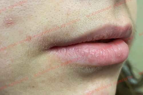 Как избавиться от усиков. О чем молчат девушки? Как избавиться от усиков? 09 Как избавиться от усиков. О чем молчат девушки? Как избавиться от усиков? 09