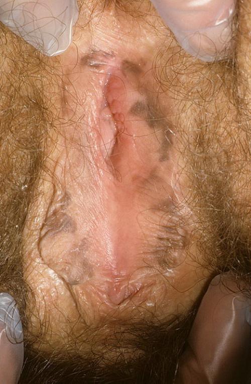 8 правил сохранения здоровья влагалища. 10 золотых правил женского здоровья: рекомендации гинеколога 05 8 правил сохранения здоровья влагалища. 10 золотых правил женского здоровья: рекомендации гинеколога 05