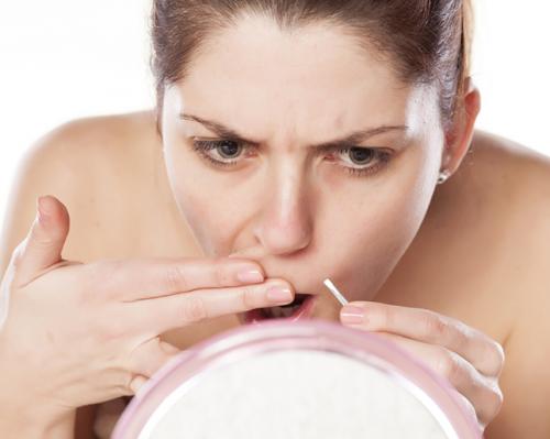 Как избавиться от усов и бороды женщине. Как удалить усы у женщин навсегда в домашних условиях?