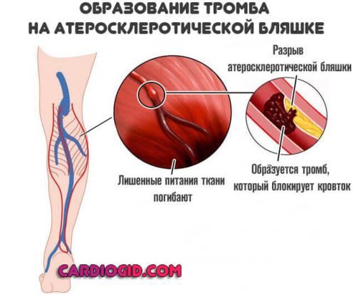 При каком холестерине надо начинать пить статины. Механизм действия