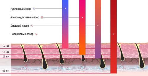 Когда нужно начинать лазерную эпиляцию? 02 Когда нужно начинать лазерную эпиляцию? 02
