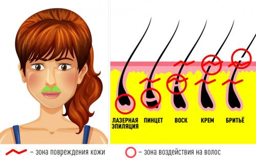 Подготовка перед лазерной эпиляцией. Как подготовиться к лазерной эпиляции? 01 Подготовка перед лазерной эпиляцией. Как подготовиться к лазерной эпиляции? 01