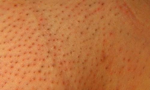 Ответы на популярные вопросы по лазерной эпиляции. Да всю правду доложи. Отвечаем на популярные вопросы о лазерной эпиляции 10