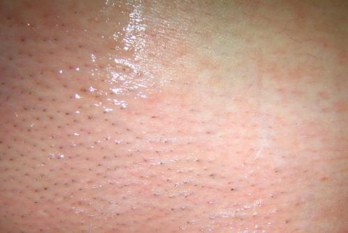 Ответы на популярные вопросы по лазерной эпиляции. Да всю правду доложи. Отвечаем на популярные вопросы о лазерной эпиляции 08