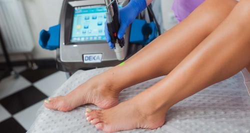 Лазерная эпиляция, как часто делать. Какой должен быть промежуток между процедурами лазерной эпиляции?