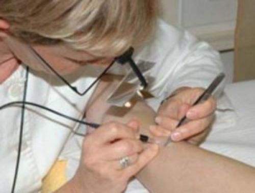 Электроэпиляция цены. Электроэпиляция сколько стоит? Сколько нужно сеансов и процедур для полного удаления волос, сколько заживает, цены +Фото