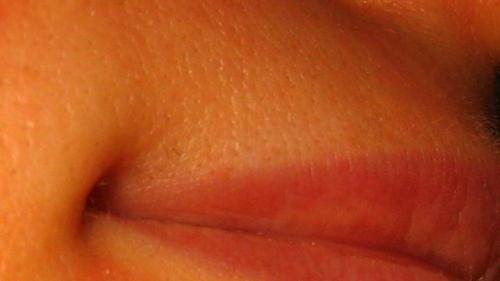 Ответы на вопросы по лазерной эпиляции. Как работает лазерная эпиляция? 10