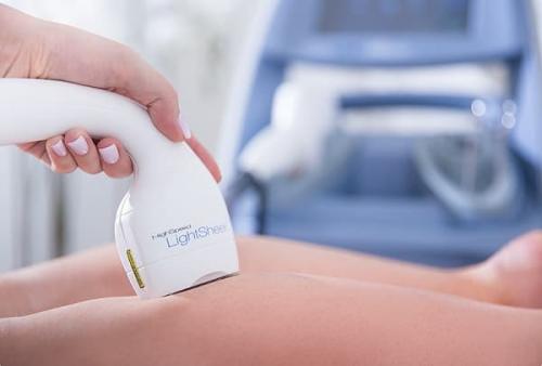 Подготовка к лазерной эпиляции. Ответы на часто задаваемые вопросы 03