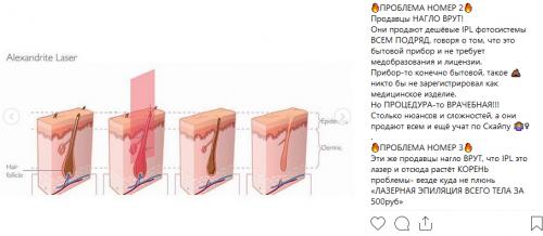 Ответы на частые вопросы по лазерной эпиляции. Можно ли делать эпиляцию на родинках? 08