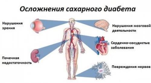Как питаться при сахарном диабете. У каждого пациента своя «диабетическая диета» 04 Как питаться при сахарном диабете. У каждого пациента своя «диабетическая диета» 04