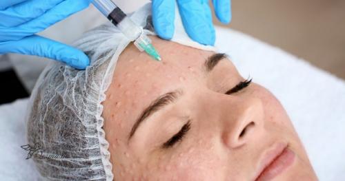 Биоревитализация или плазмолифтинг форум. Сочетание с другими процедурами