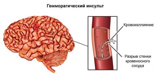 10 главных упражнений для тех. Топ-50 упражнений стоя для начинающих и для любого возраста: без прыжков и приседаний (+ план на 5 дней) 04 10 главных упражнений для тех. Топ-50 упражнений стоя для начинающих и для любого возраста: без прыжков и приседаний (+ план на 5 дней) 04