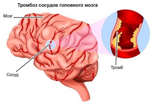 10 главных упражнений для тех. Топ-50 упражнений стоя для начинающих и для любого возраста: без прыжков и приседаний (+ план на 5 дней) 03 10 главных упражнений для тех. Топ-50 упражнений стоя для начинающих и для любого возраста: без прыжков и приседаний (+ план на 5 дней) 03