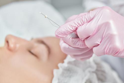 Коррекция гусиных лапок. Американская блефаропластика Фраксель 02