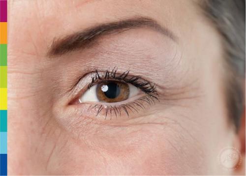 Избавиться от морщин под глазами. Как избавиться от морщин возле глаз 01