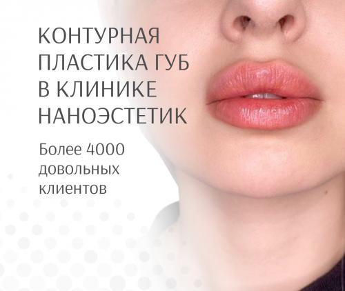 Отек после Ботокса. Причины осложнений 02