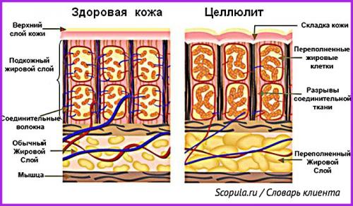 Вакуумно-роликовый массаж, как делать. Проведение процедуры