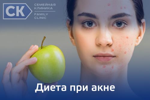 Советы экспертов при лечении прыщей. Чистая кожа раз и навсегда! Как победить акне? 04 Советы экспертов при лечении прыщей. Чистая кожа раз и навсегда! Как победить акне? 04