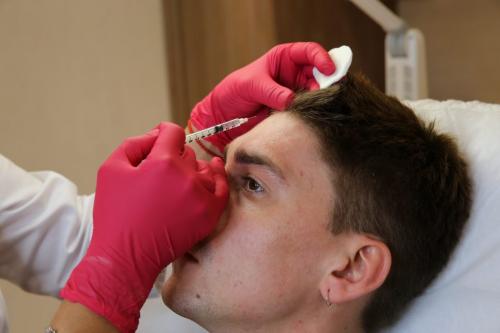 Лоб ботокс до и после. Мимические морщины на лбу (ботокс в лоб) 03