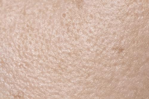 Как избежать появления заломов под глазами на основе своего типа кожи. Особенности строения кожи