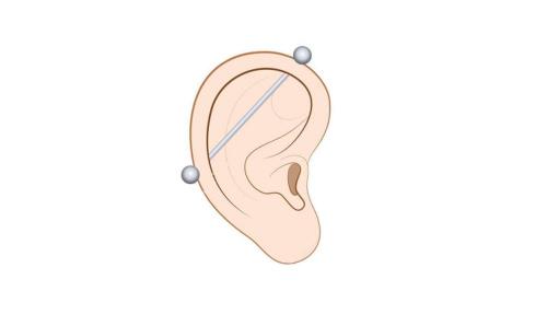 Сколько заживают проколы в ушах. Все виды пирсинга уха