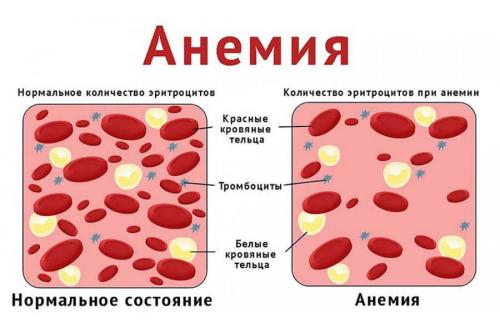 При ВИЧ лимфоциты повышены или понижены. Показатели крови при ВИЧ