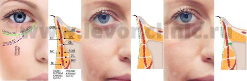 Тонкая кожа под глазами. Давайте взглянем на анатомическое строение области глаз.