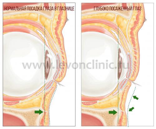 Тонкая кожа под глазами. Давайте взглянем на анатомическое строение области глаз.