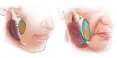 Тонкая кожа под глазами. Давайте взглянем на анатомическое строение области глаз. 12