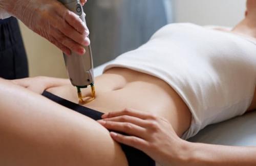 Не выпадают волосы после лазерной эпиляции. В чем отличие эпиляции и депиляции? Кому, что подходит? И что эффективнее? 11