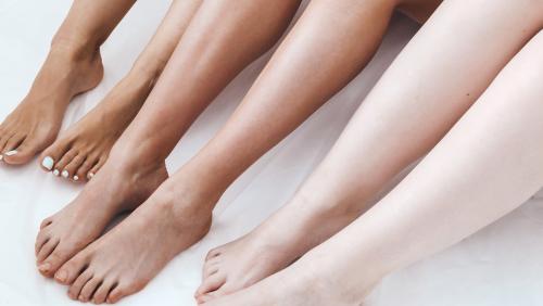 Не выпадают волосы после лазерной эпиляции. В чем отличие эпиляции и депиляции? Кому, что подходит? И что эффективнее? 04