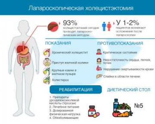 Послеоперационная диета: что нужно знать после лапароскопии желчного пузыря 01 Послеоперационная диета: что нужно знать после лапароскопии желчного пузыря 01