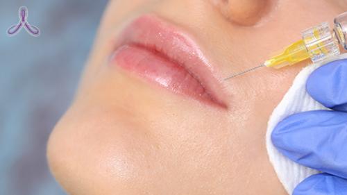 Как убрать кисетные морщины 06