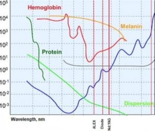Можно ли делать лазерную эпиляцию на загорелую кожу. Лазер для эпиляции на темной коже