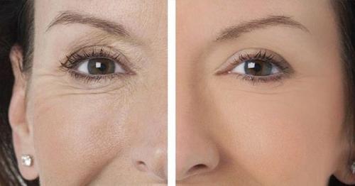 Лучший крем вокруг глаз после 30 рейтинг. Почему так важно ухаживать за кожей вокруг глаз после 30 лет