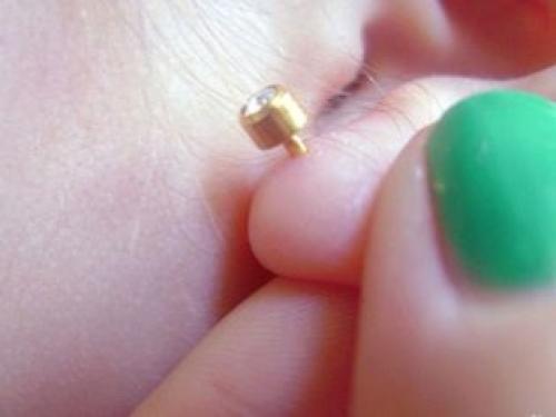 Гноится прокол уха. Как ухаживать за проколотыми ушами?