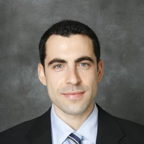 ТОП лучших процедур вокруг глаз. Почему появляются синяки и круги под глазами? 01