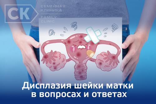 Шейка матки снаружи выстлана многослойным плоским эпителием.. II. Истинная эрозия шейки матки 02 Шейка матки снаружи выстлана многослойным плоским эпителием.. II. Истинная эрозия шейки матки 02