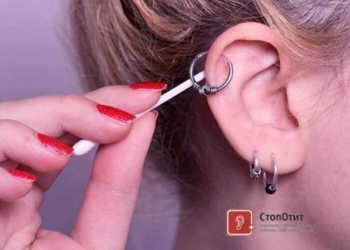 За сколько зарастает дырка от пирсинга в носу. Как проводится операция? 01